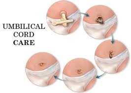 Knitted umbilical cord ties pattern