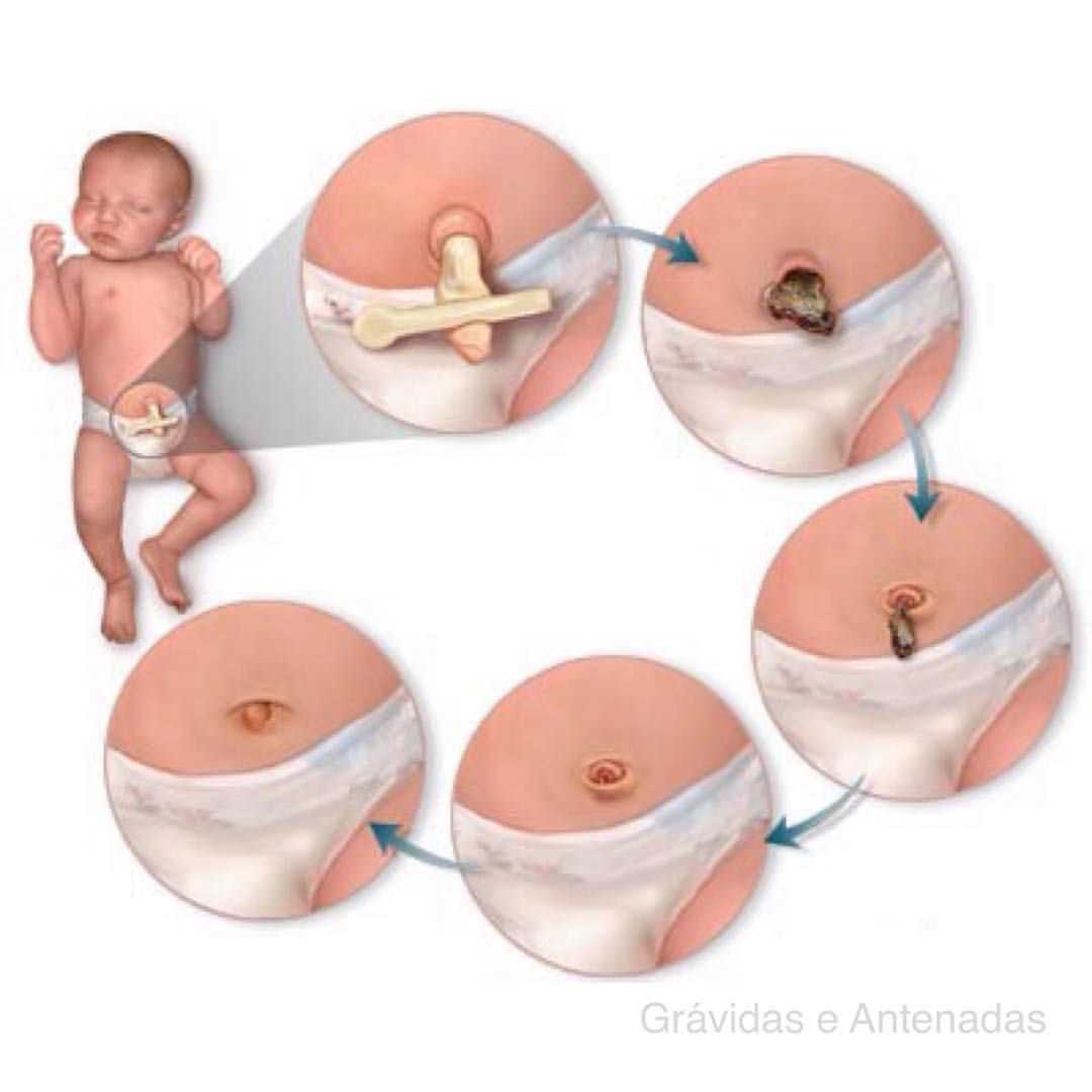 Knitted umbilical cord ties pattern