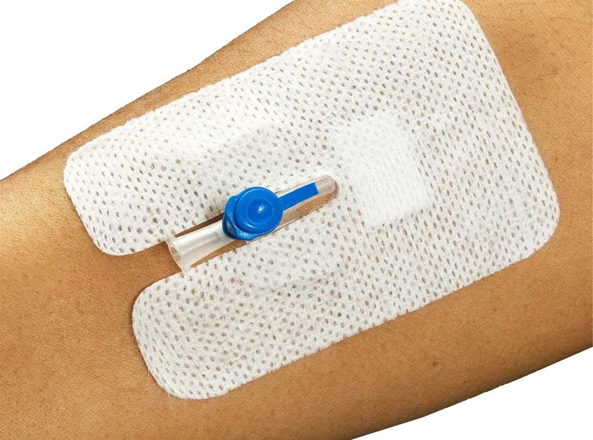 Knitted cannula sleeve pattern